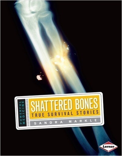 Shattered Bones: True Survival Stories
